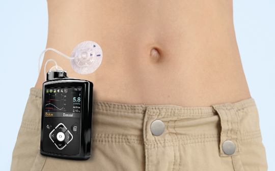 FDA approves 1st automated, tubeless insulin pump for people with Type 1  diabetes - Good Morning America
