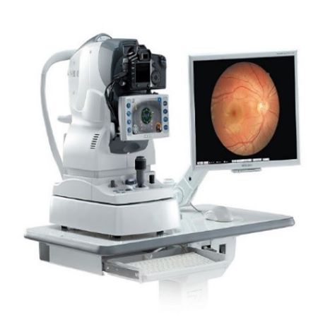Foto funduscamera oogonderzoek diabetes