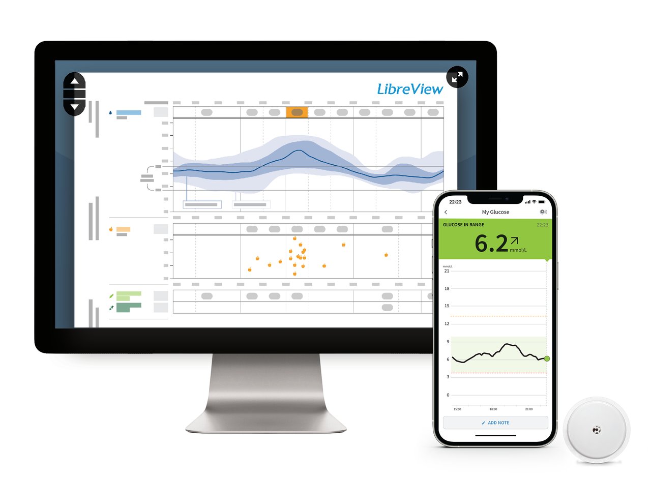 Glucosedata delen