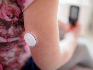 Flash Glucose Monitoring: vergoeding update